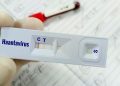 Warga Kulon Progo Suspek Virus Hanta Telah Dinyatakan Negatif