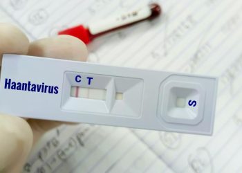 Warga Kulon Progo Suspek Virus Hanta Telah Dinyatakan Negatif