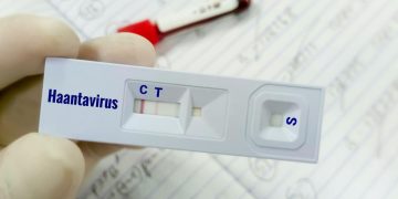 Warga Kulon Progo Suspek Virus Hanta Telah Dinyatakan Negatif