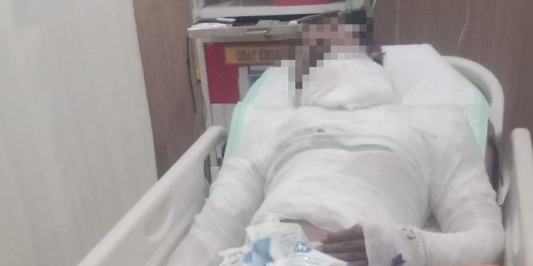 Sopir Truk Bali yang Dibakar Bosnya Meninggal Dunia setelah Seminggu Kritis